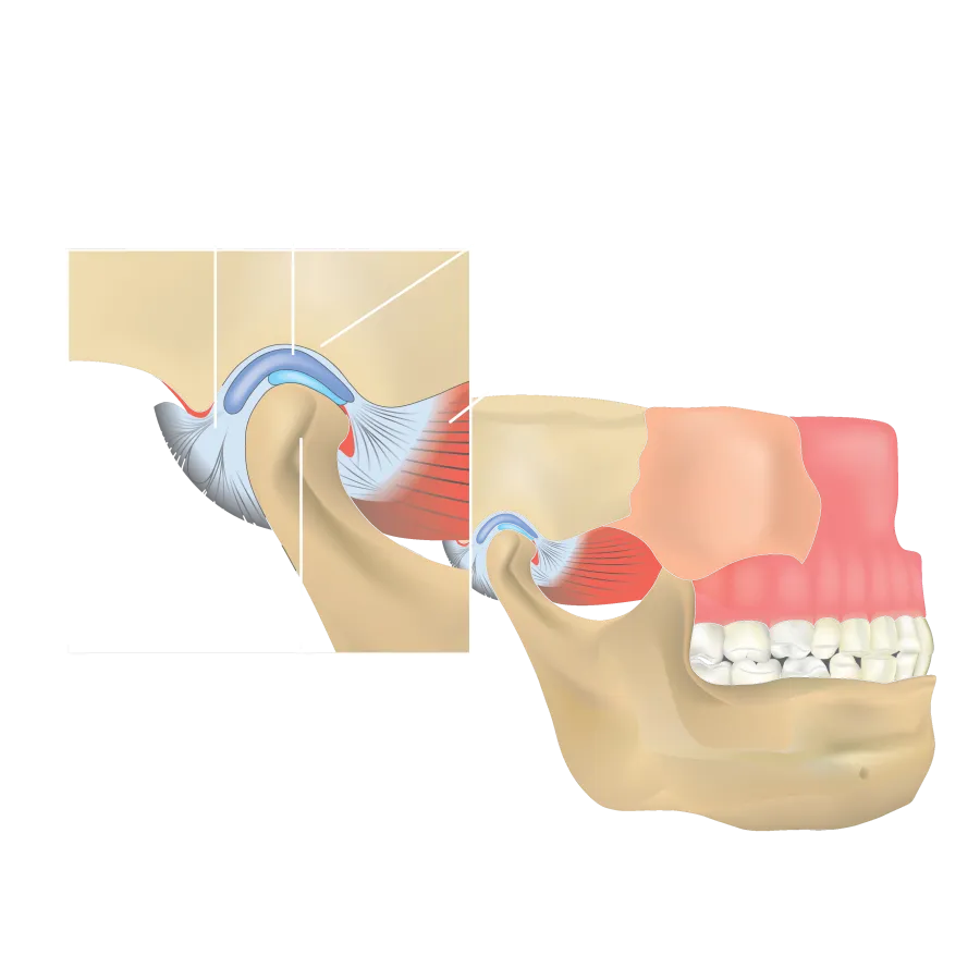 Illustration of the temporomandibular joint showing ligament, disk, condyle, articular fossa, and muscle.
